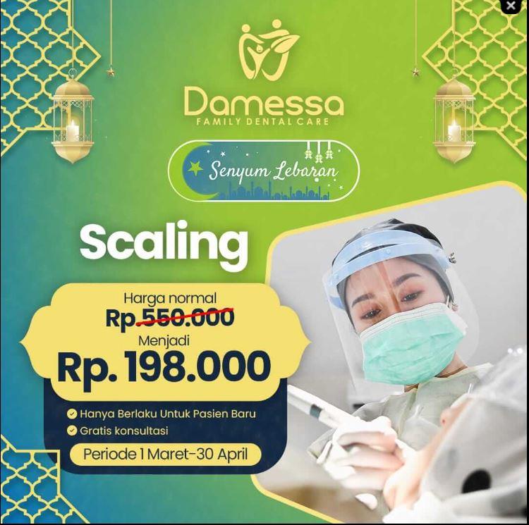 Pentingnya Scaling Gigi Secara Berkala, Yuk Jangan Abai Lagi 1